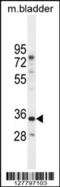 BLOC-1 Related Complex Subunit 6 antibody, 55-564, ProSci, Western Blot image 