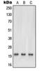 Ras antibody, LS-C352318, Lifespan Biosciences, Western Blot image 