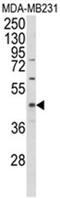 PHD1 antibody, AP18002PU-N, Origene, Western Blot image 