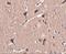 Zinc Finger Protein 667 antibody, A13622, Boster Biological Technology, Immunohistochemistry frozen image 