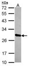 HscB Mitochondrial Iron-Sulfur Cluster Cochaperone antibody, NBP2-16883, Novus Biologicals, Western Blot image 