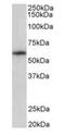 TXK Tyrosine Kinase antibody, orb20187, Biorbyt, Western Blot image 