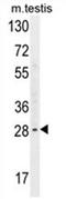YdjC Chitooligosaccharide Deacetylase Homolog antibody, AP54593PU-N, Origene, Western Blot image 