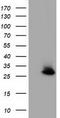 Glutathione S-Transferase Theta 2 (Gene/Pseudogene) antibody, TA501829, Origene, Western Blot image 