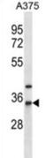 N-Acetyltransferase 1 antibody, abx027256, Abbexa, Western Blot image 