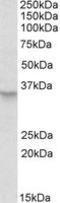 Peroxisomal Biogenesis Factor 2 antibody, LS-C113007, Lifespan Biosciences, Western Blot image 