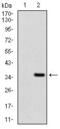 Fibroblast Growth Factor 4 antibody, GTX60747, GeneTex, Western Blot image 