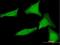 Small Glutamine Rich Tetratricopeptide Repeat Containing Alpha antibody, H00006449-B01P, Novus Biologicals, Immunocytochemistry image 