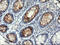 STK38L antibody, LS-C174221, Lifespan Biosciences, Immunohistochemistry paraffin image 
