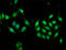 Musashi RNA Binding Protein 1 antibody, LS-C673446, Lifespan Biosciences, Immunofluorescence image 