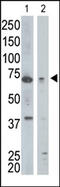 Golgi Associated, Gamma Adaptin Ear Containing, ARF Binding Protein 1 antibody, AP12154PU-N, Origene, Western Blot image 