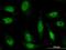 Zinc Finger Protein 181 antibody, MA5-23257, Invitrogen Antibodies, Immunofluorescence image 