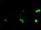 LIM/homeobox protein Lhx1 antibody, MA5-25922, Invitrogen Antibodies, Immunocytochemistry image 