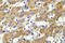 Cytochrome P450 Family 2 Subfamily C Member 8 antibody, LS-C176856, Lifespan Biosciences, Immunohistochemistry paraffin image 