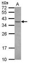 Ventral Anterior Homeobox 1 antibody, GTX109559, GeneTex, Western Blot image 