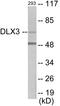 Distal-Less Homeobox 3 antibody, EKC1637, Boster Biological Technology, Western Blot image 