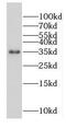 OTU Deubiquitinase With Linear Linkage Specificity Like antibody, FNab02952, FineTest, Western Blot image 