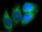 Family With Sequence Similarity 114 Member A1 antibody, 21638-1-AP, Proteintech Group, Immunofluorescence image 