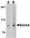 SLIT And NTRK Like Family Member 4 antibody, TA306533, Origene, Western Blot image 
