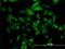 Four and a half LIM domains protein 5 antibody, H00009457-M01, Novus Biologicals, Immunocytochemistry image 
