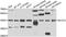 Branched Chain Amino Acid Transaminase 2 antibody, A06369, Boster Biological Technology, Western Blot image 