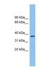Aldo-keto reductase family 1 member C2 antibody, NBP1-57770, Novus Biologicals, Western Blot image 