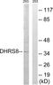 Hydroxysteroid 17-Beta Dehydrogenase 11 antibody, A30636, Boster Biological Technology, Western Blot image 