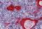 Stratifin antibody, MBS246477, MyBioSource, Immunohistochemistry paraffin image 