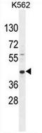 Rab effector Noc2 antibody, AP53705PU-N, Origene, Western Blot image 