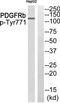 Platelet Derived Growth Factor Receptor Beta antibody, TA312019, Origene, Western Blot image 