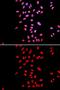 Dyskerin Pseudouridine Synthase 1 antibody, GTX32562, GeneTex, Immunofluorescence image 