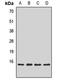 SNAP Associated Protein antibody, orb411718, Biorbyt, Western Blot image 