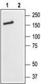 Glutamate Ionotropic Receptor NMDA Type Subunit 2B antibody, TA328822, Origene, Western Blot image 