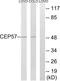 Centrosomal Protein 57 antibody, LS-B5984, Lifespan Biosciences, Western Blot image 