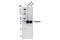 Voltage-dependent calcium channel gamma-2 subunit antibody, 8511S, Cell Signaling Technology, Western Blot image 