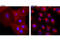 EGFR antibody, 8742S, Cell Signaling Technology, Immunocytochemistry image 