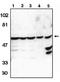 Dual specificity tyrosine-phosphorylation-regulated kinase 1A antibody, orb108698, Biorbyt, Western Blot image 