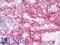Endoglin antibody, LS-B9998, Lifespan Biosciences, Immunohistochemistry frozen image 