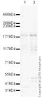 SMG6 Nonsense Mediated MRNA Decay Factor antibody, ab87539, Abcam, Western Blot image 