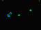 Glucokinase antibody, orb44815, Biorbyt, Immunofluorescence image 