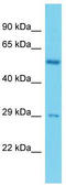 Shiftless Antiviral Inhibitor Of Ribosomal Frameshifting antibody, TA330678, Origene, Western Blot image 