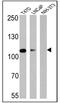 Androgen Receptor antibody, NB300-615, Novus Biologicals, Western Blot image 