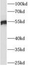 Iduronate 2-Sulfatase antibody, FNab04130, FineTest, Western Blot image 