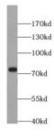 PID antibody, FNab05389, FineTest, Western Blot image 