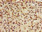 Forkhead Box D3 antibody, CSB-PA890729LA01HU, Cusabio, Immunohistochemistry paraffin image 