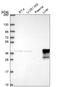 Alcohol Dehydrogenase 6 (Class V) antibody, HPA069081, Atlas Antibodies, Western Blot image 
