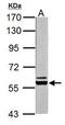 Pyruvate Kinase L/R antibody, PA5-22178, Invitrogen Antibodies, Western Blot image 