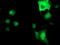 ATPase H+ Transporting V1 Subunit B1 antibody, TA502519, Origene, Immunofluorescence image 