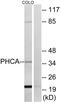 Alkaline Ceramidase 3 antibody, PA5-39017, Invitrogen Antibodies, Western Blot image 