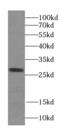 STARD3 N-Terminal Like antibody, FNab08290, FineTest, Western Blot image 